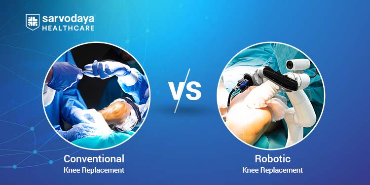 Conventional vs. Robotic Knee Replacement: Understanding the Differences