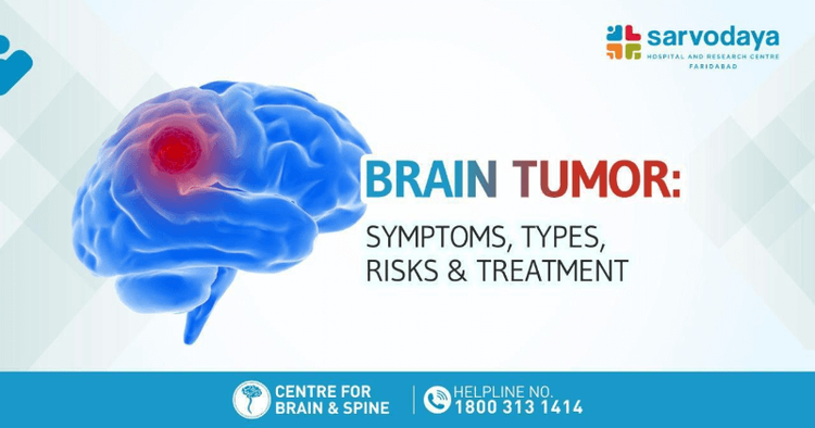 Brain Tumor - Symptoms, Types, Risk, & Treatment