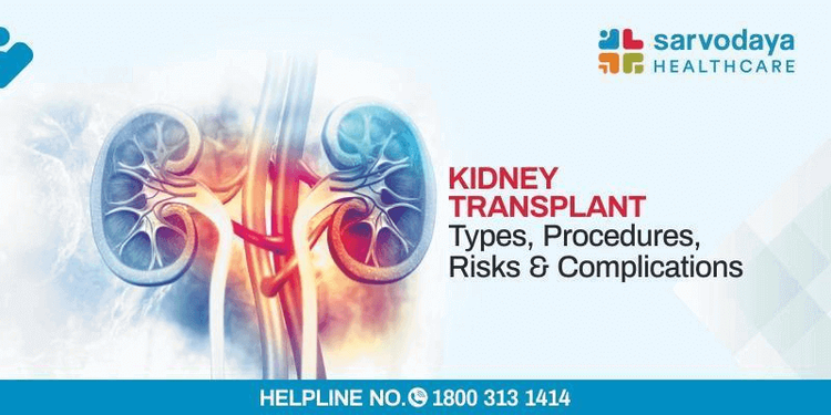 Kidney Transplant - Types, Procedure, Risks, &  Complications