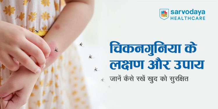चिकनगुनिया के लक्षण और उपाय: जानें कैसे रखें खुद को सुरक्षित