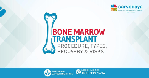 Bone Marrow Transplant: Procedure, Types and Risks