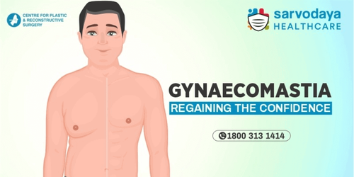 Gynaecomastia: Regaining The Confidence