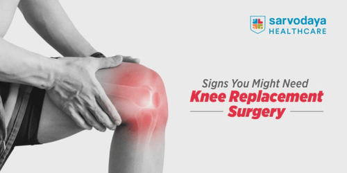 Signs You Might Need Knee Replacement Surgery