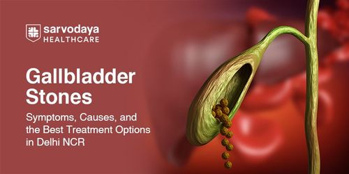 Gallbladder Stones: Symptoms, Causes, and the Best Treatment Options