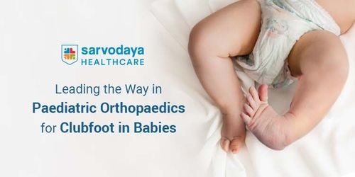 Sarvodaya Hospital: Leading the Way in Pediatric Orthopaedics for Clubfoot in Babies